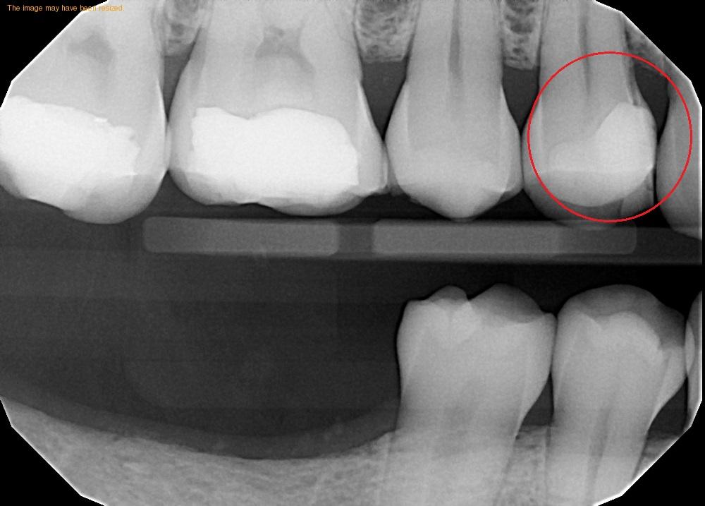 dentist glenmont ny