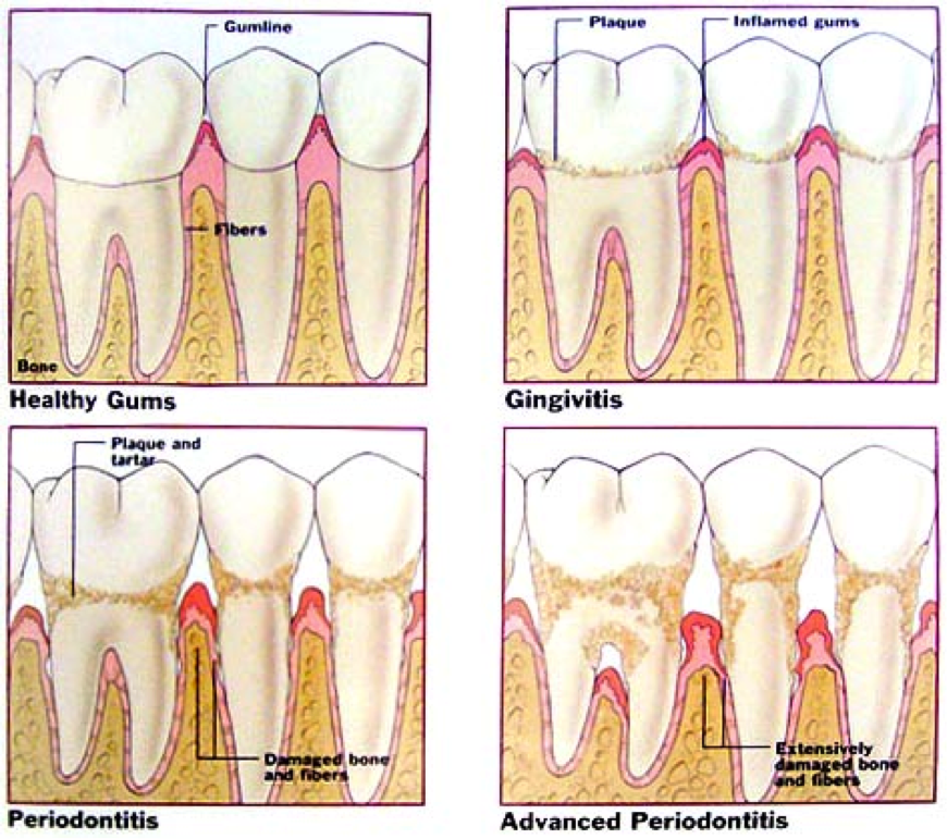 peridontal treatment glenmont | dentist glenmont ny