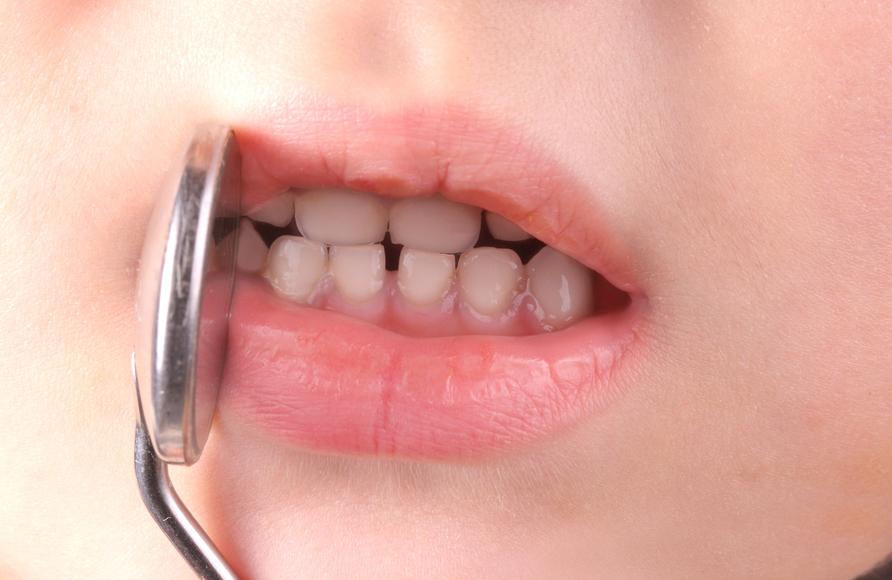 childrens dentist glenmont ny